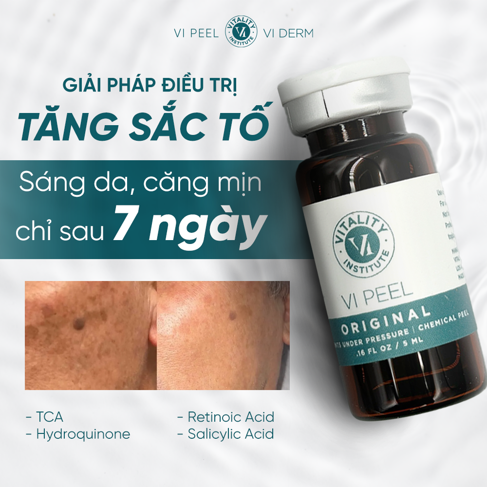 VI Peel cải thiện làn da trong vòng 7 ngày