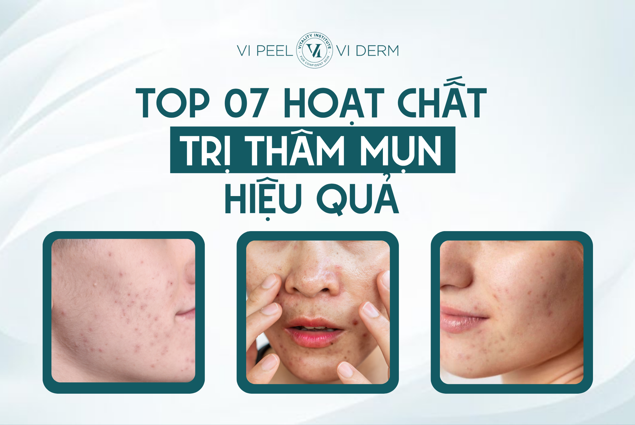 Điểm danh 07 hoạt chất trị thâm mụn hiệu quả hiện nay