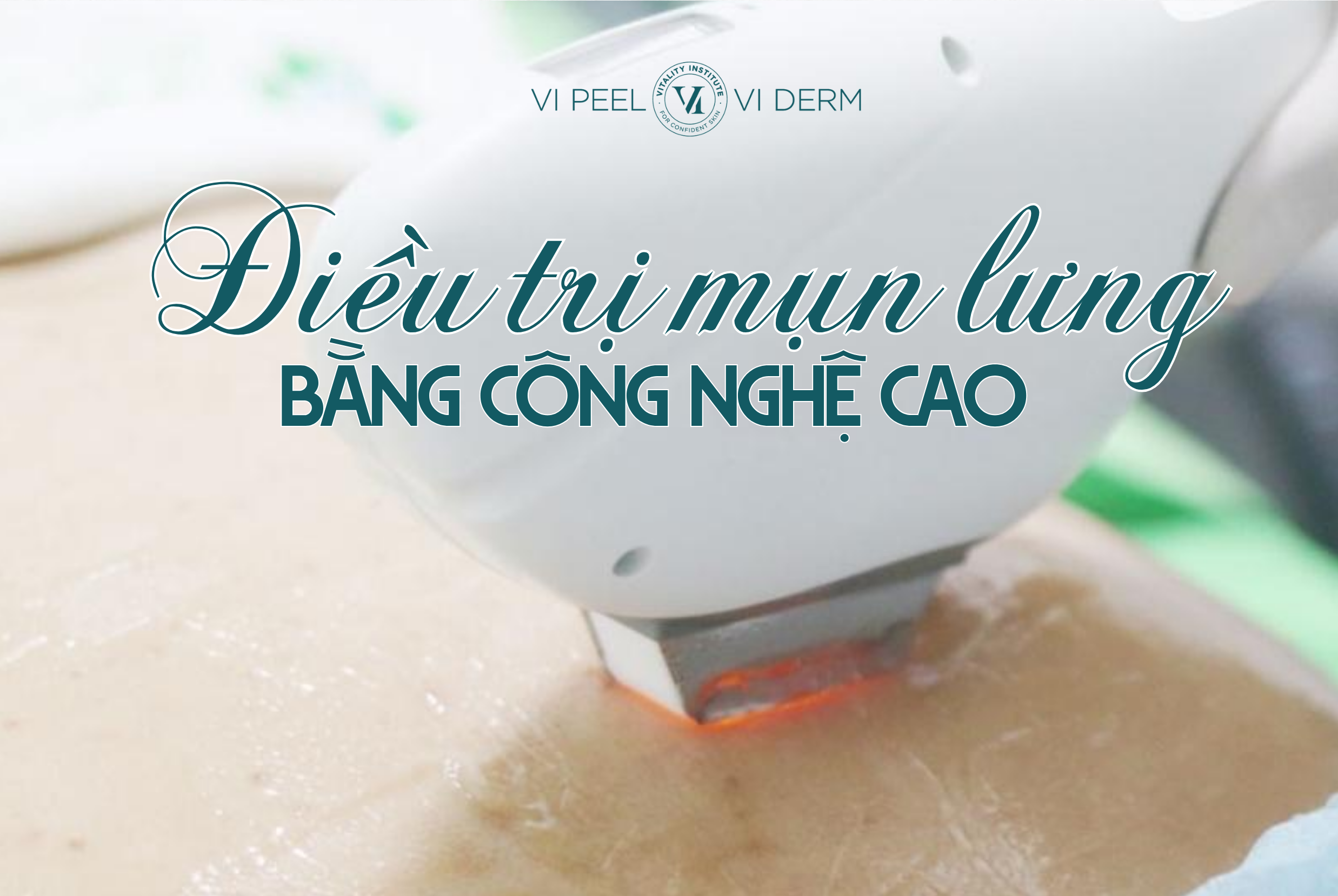 Khi mụn lưng ở mức độ trung bình đến nặng, hoặc có dấu hiệu viêm sâu, tái phát liên tục, các phương pháp điều trị bằng công nghệ cao sẽ mang lại hiệu quả vượt trội