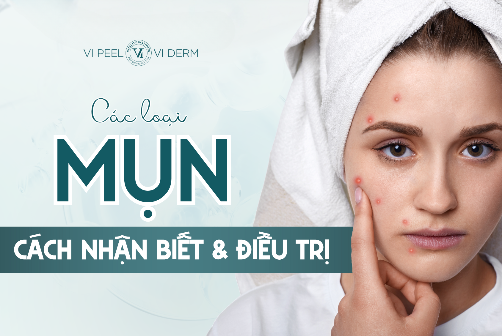 Mụn có mấy loại? Cách nhận biết và điều trị hiệu quả